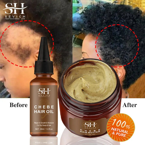 Fast Hair Growth Set Chebe Oil Traction Alopecia Hair Strengthen Mask Anti Break Loss New Africa Baldness Treatment Care Essence