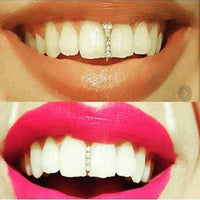 Teeth Grillz Pure Gold Plating Braces Jewelry